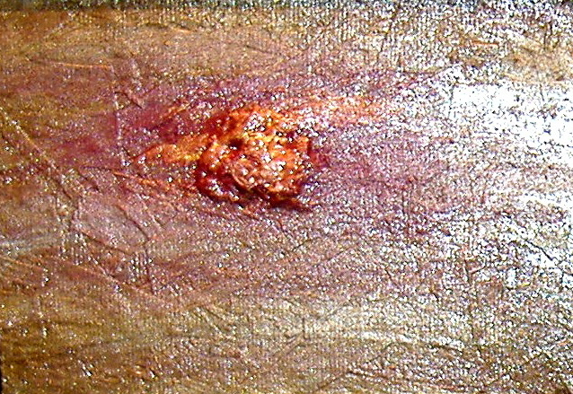 "Protobiont I" by Artist A. Wilson